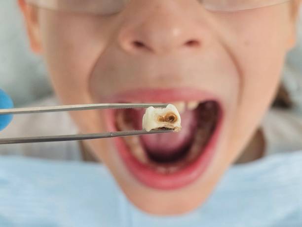 Best Walk-In Emergency Dentist in Coral Hills, MD